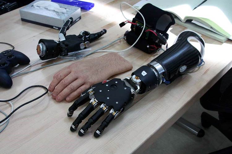 Prosthetic Devices