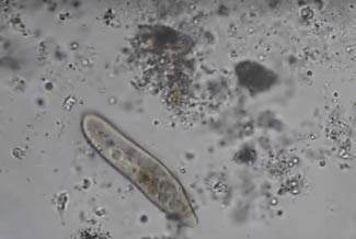 mind-controlled-microbes-Paramecium-1