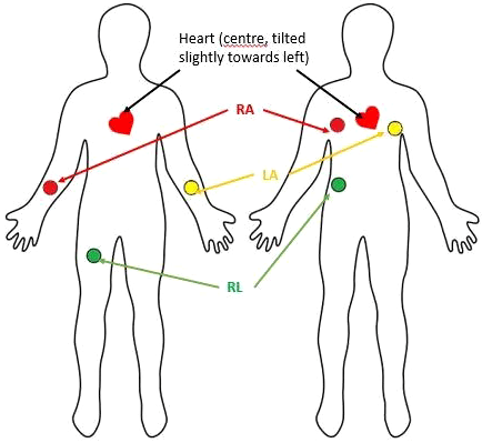 ECG Electrodes Placement 